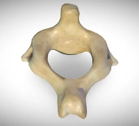 PBR Game 3D Models – 2Nd Cervical Vertebra (Axis)