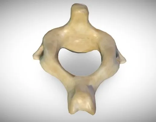 PBR Game 3D Models – 2Nd Cervical Vertebra (Axis)
