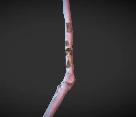 PBR Game 3D Models – Arm With Lytic Lesions