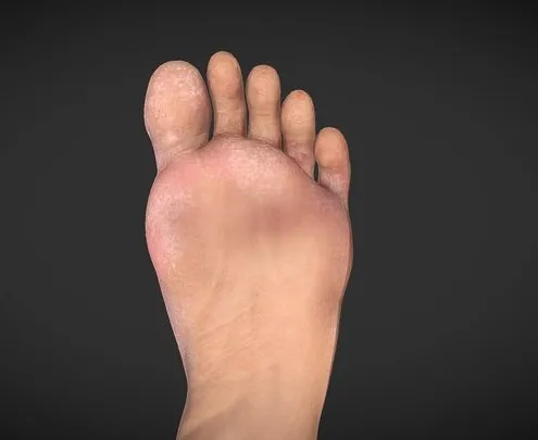 PBR Game 3D Models – Athlete’s Foot