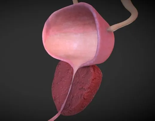 PBR Game 3D Models – Benign Prostatic Hyperplasia