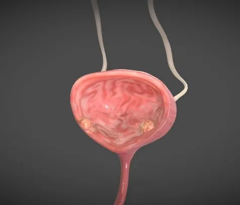 PBR Game 3D Models – Bladder Cancer