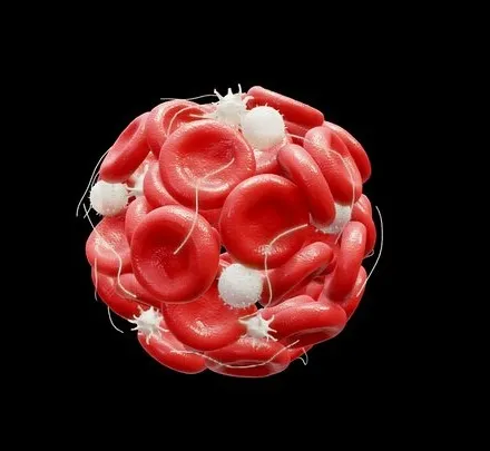 PBR Game 3D Models – Blood Clot Thrombus