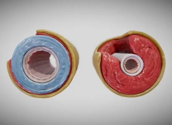 PBR Game 3D Models – Elastic Vs Muscular Artery (Animated)